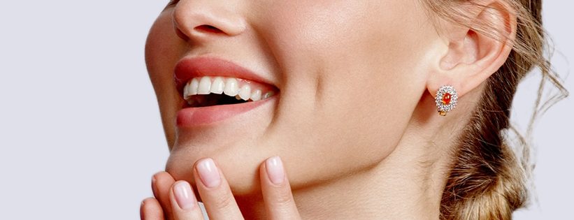 Gummy_Smile_Treatment