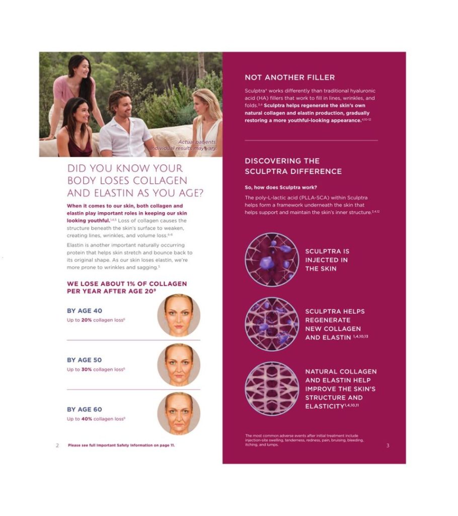 Sculptra_2