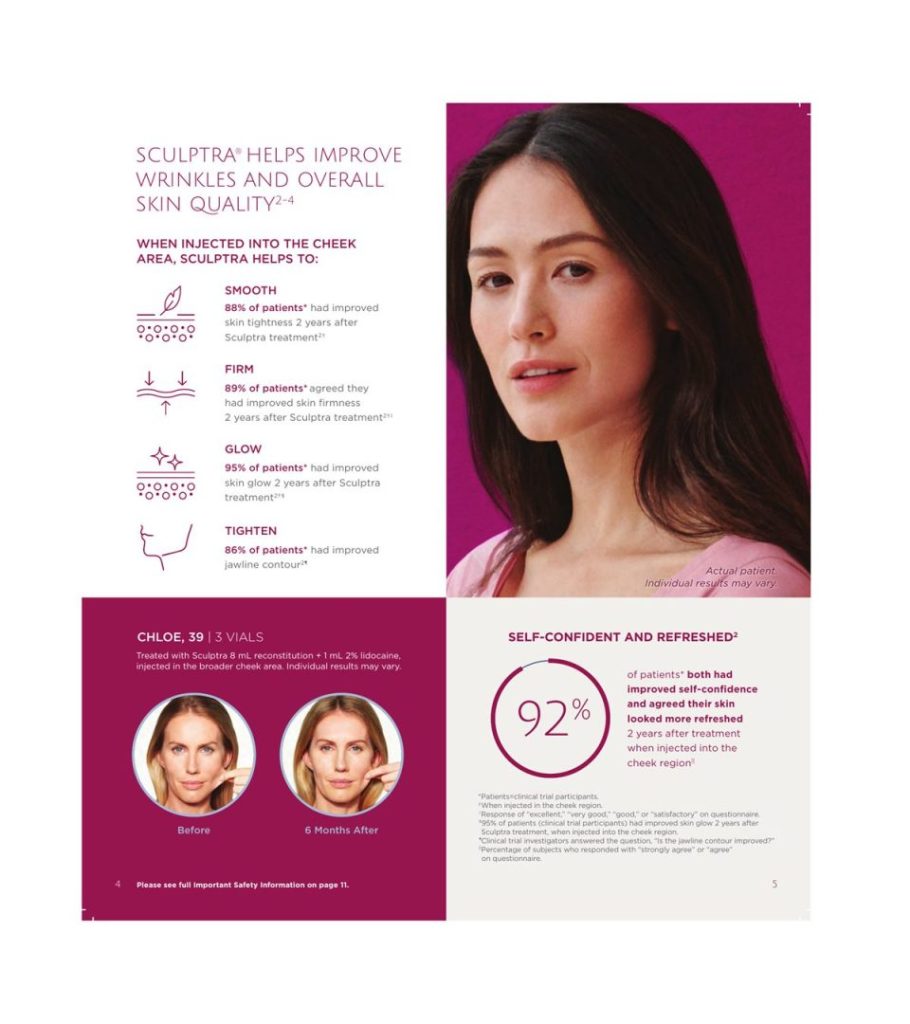 Sculptra_3