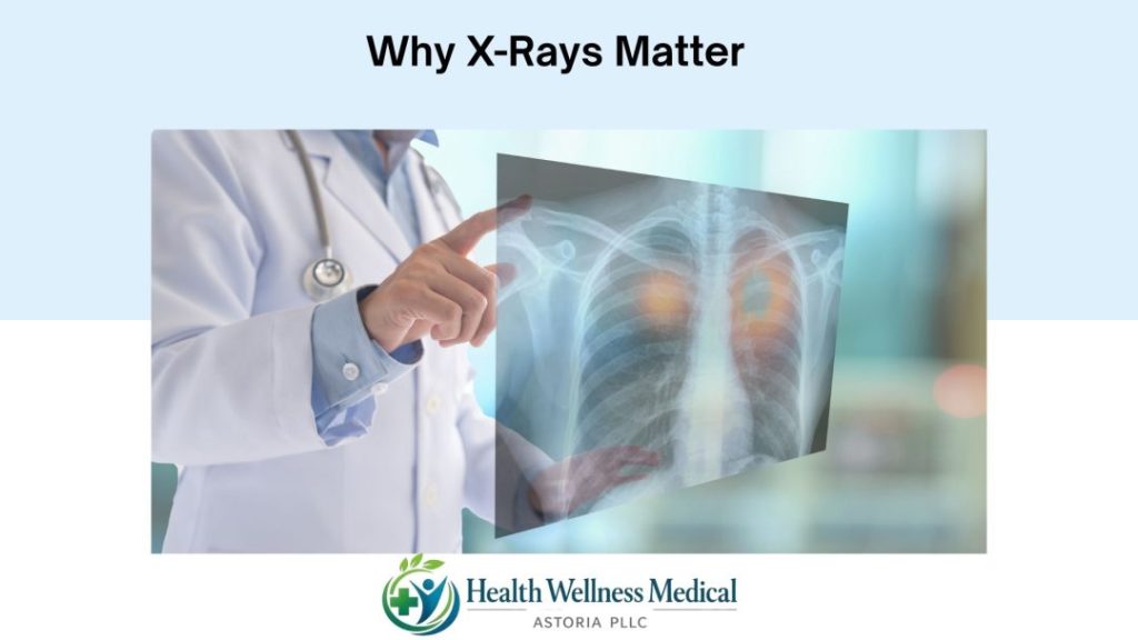 Why X-Rays Matter in Urgent Care Astoria ,NY