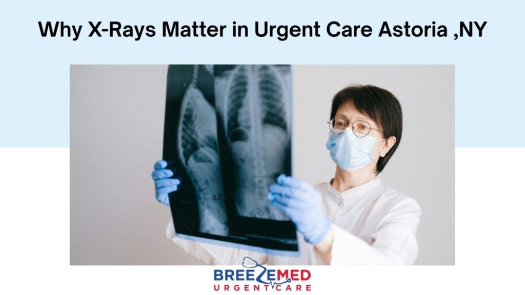 Why X-Rays Matter in Urgent Care Astoria ,NY